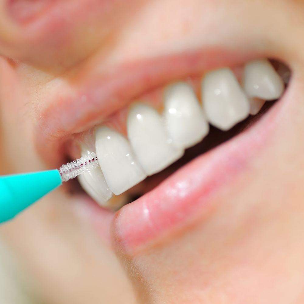 Brossettes interdentaires